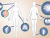 15 signes précoces du lupus que vous ne devez en aucun cas négliger