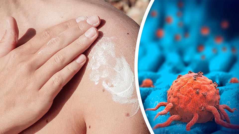 Votre crème solaire augmente-t-elle vos risques de cancer de la peau? Découvrez quel est le choix le plus sûr.